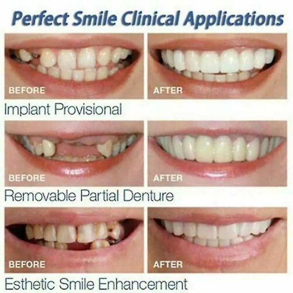 Smile seler Snap på øvre og nedre falske tænder Dental Finer Protese Cover Set 2 Set