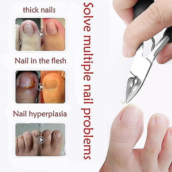 Tånagelklippare Set Tjock inåtväxt tånaglar Precisionsnagelverktyg Sax Röd Red