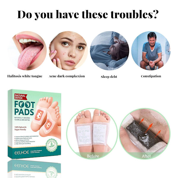 Eelhoe Cleansing Foot Patch hjälper sömn, slappnar av kropp och själ, driver ut kyla, fukt, gifter, renar huden, ger näring åt kroppen, lindrar stress Fotklapp