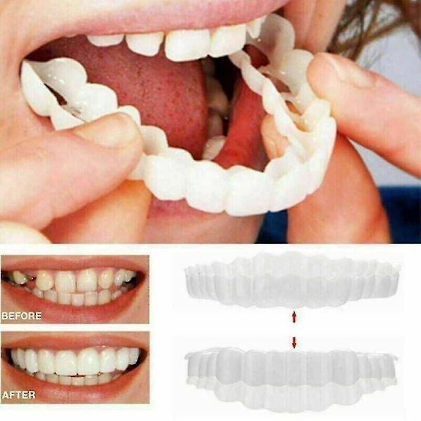 1 st Smile Snap On Övre Falsk Tooth Tandfasader Tandproteser Fake Teeth Cover