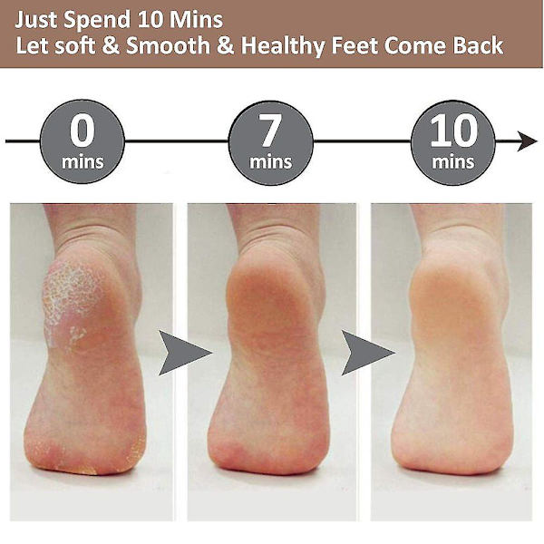 Pedikyr Foot File Callus Remover - stor fotrasp Colossal Foot Scrubber Professionell rostfritt stål Hårdfil för våta och torra fötter