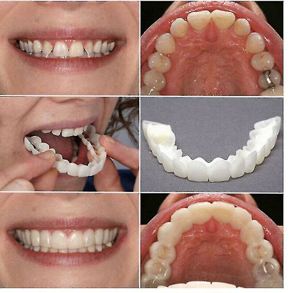 Snap On falske tænder, øvre + nedre tandfacader, proteser, tandsæt A Upper Lower teeth