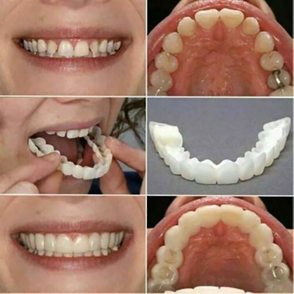 Smile seler Snap On øvre falske tænder Dental Finer Protese Cover Set