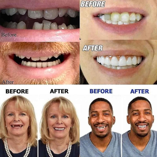 Kunstige tandproteser Midlertidig hurtig tandprotese Top Perfect Smile Finer, Reparer din tand hurtigt, Få dig til at smile trygt