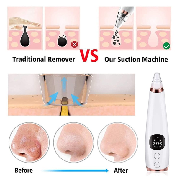 Blackhead Remover USB Charging with 6 Interchangeable Cleaning
