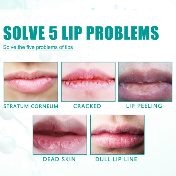 Anti-cracking Lip Care Liquid Reduce Dead Skin Care Läppförband 30ml