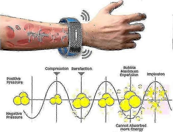 Ultraljudsarmband för kroppsskulptering - Magnetiska armband för lymfdränage Blue