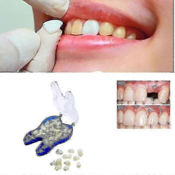 Temporary Denture Occlude Upper Dentures Veneer Dentures Missing Teeth Zekai