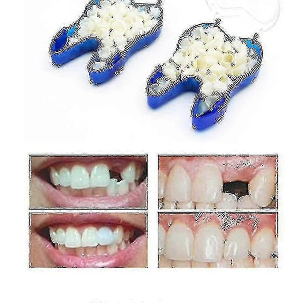 Temporary Denture Occlude Upper Dentures Veneer Dentures Missing Teeth Zekai