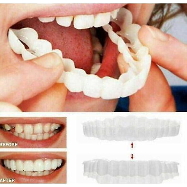 1 stk. Smile Snap On Øvre Falsk Tann Dental Veneers Proteser Falske Tenner Deksel