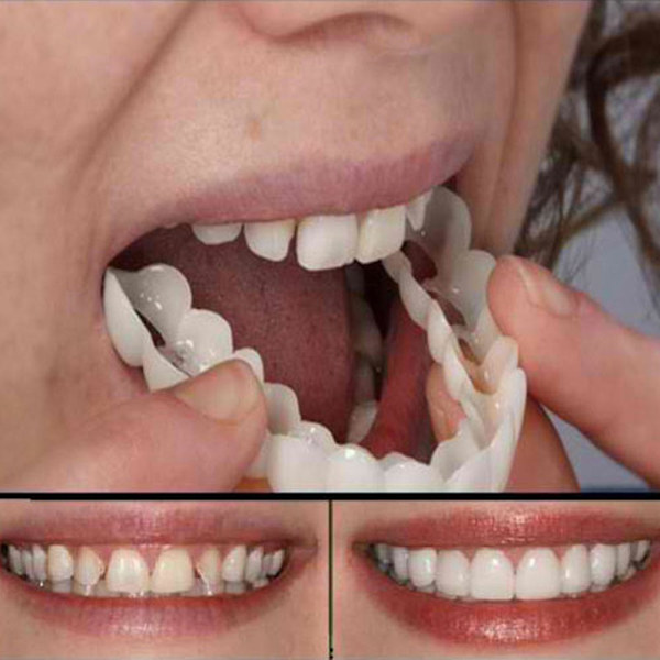1/2 stk. Smile Løstenner Tilpass Flex Kosmetiske Tenner Komfortabel Finérdeksel
