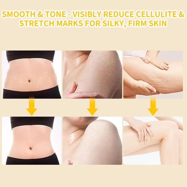 [LCS] Electric Lymphatic Massager - Deep Cellulite & Body Massage with Display