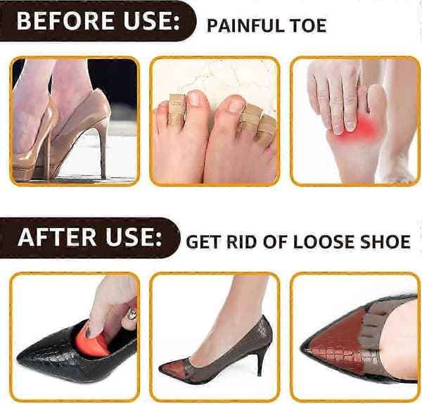 [LCS]Skofyldningsindlæg 2 par, tåpudeindlæg til at få store sko til at passe, bløde halvstørrelsesindlæg til løse sko 2Pairs Orange pointed