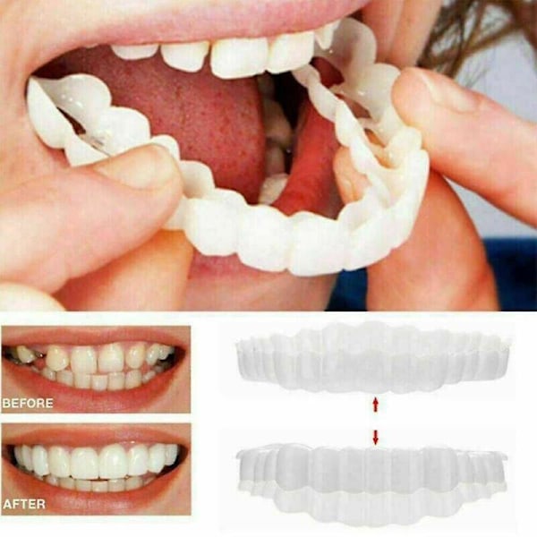 1 ST Smile Snap On Övre Falsk Tand Dental Fanér Proteser Falska Tänder Skydd