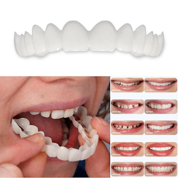 1/2 stk. Smile Løstenner Tilpass Flex Kosmetiske Tenner Komfortabel Finérdeksel