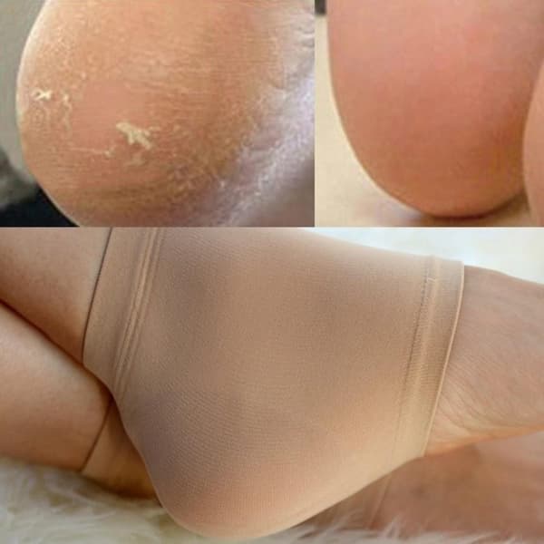 Silikone hælbeskyttere, beige, størrelse 39-43, til hælspore og revnede hæle