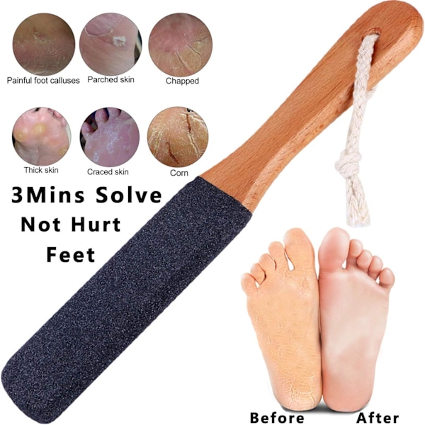 Fodfil Callusfjerner Professionel Pedicure Fjern Sprukne Hæle Død Hud Hård Hud Fod Bimsstein Rasp