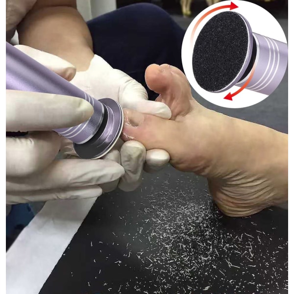 Opgraderet elektrisk fodsliber Callus Remover (hastighedsjusterbar) med 60 stk erstatningssandpapirskiver til fjernelse af normal fødder død hud, nej