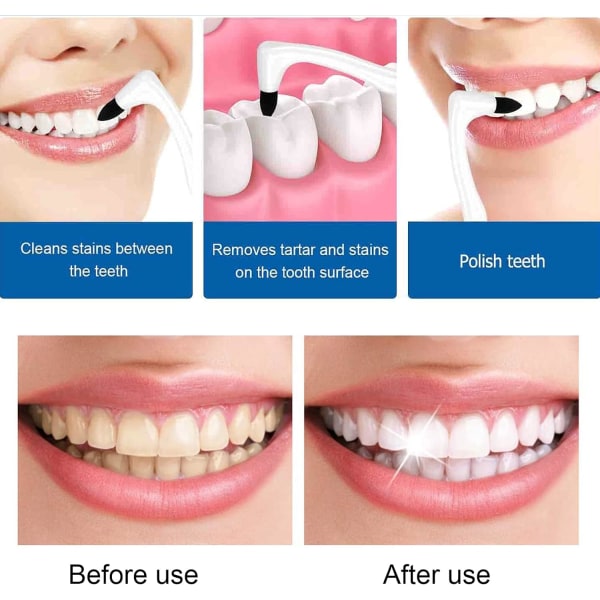3 kpl hammaskivenpoistoaine (8*2,5 cm), hampaiden kiillotustahra hammaskivenpoistoaine Re