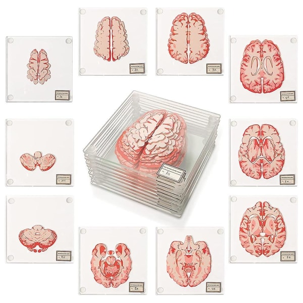 Halloween Anatomy Brain Specimen Coaster - Medical Student Gift Brain Decoration Human Anatomy Gift