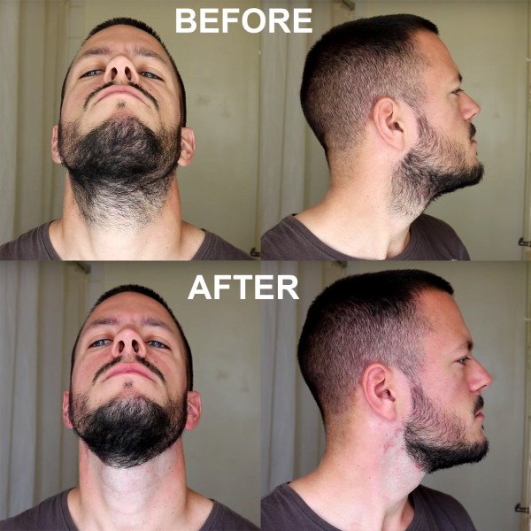 2 stk-skjeggtrimmeguide for menn, skjegg- og halsformende sjablong for menn
