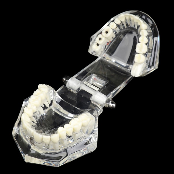 Dental Model Im Restoration Bridge for Study Tooth Science