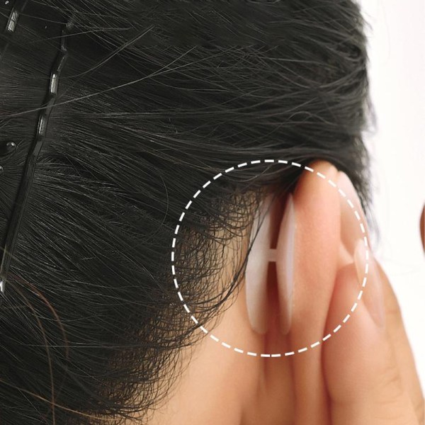 10 stk usynlige utstående ører korrigerende tape øre estetisk White
