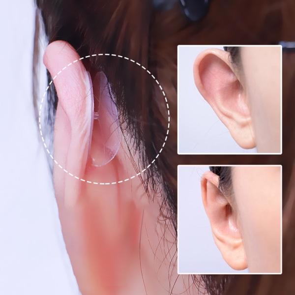 10 stk. usynlige udstående ører korrekturtape øre æstetisk White