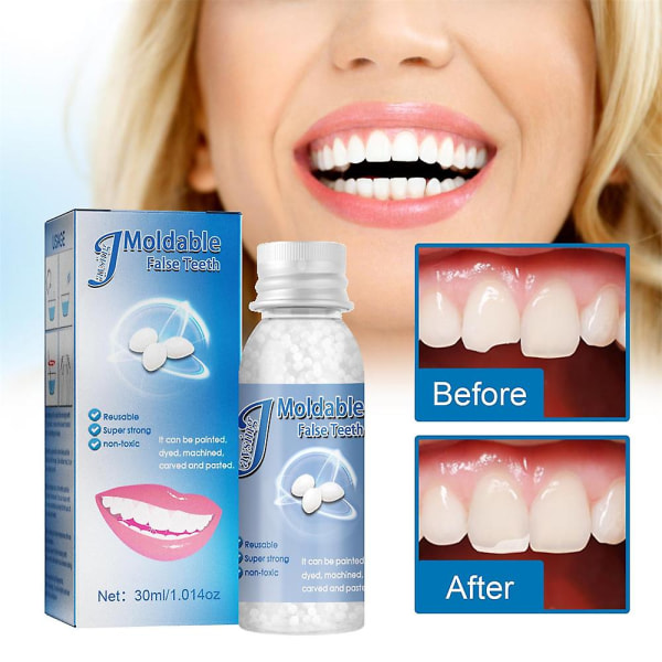 Formbar fast tandlim-film och tv-sminkprotesmodifiering Temporär fyllning Tandlimprotes Trasiga tänder fyllning tandhåla