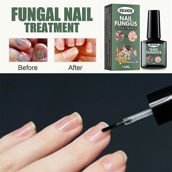 Extra Strength Nagelreparationsvätska Tånagel- och nagellösning Tånaglar och naglar Reparation Skadade och missfärgade naglar Naturliga tillbehör 1PC