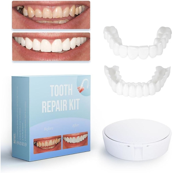 Tandbytessats, ersätt en saknad tand på några minuter, naturfaner för tillfällig reparation, komplettera ditt leende med falsk tand
