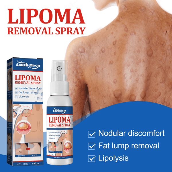 Lipomfjerningsspray Kropp Subkutan Lipom Muddertåke Mild urtebasert ingrediensspray default（ca）