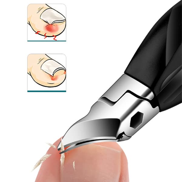 Angled Nail Clippers with Extended Handle for Ingrown Nails - Precision Podiatry Tool