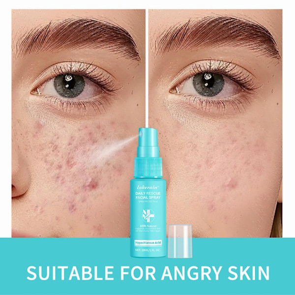Hypoklorsyra Spray Ansikte, Daglig Res-cue Ansikts 30ml AU 2025 Spray W7E9