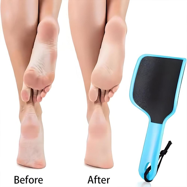 Dubbelsidig fotfil Exfoliator Vårdverktyg Rakhyvel Skrapa R7X5 green 1pcs