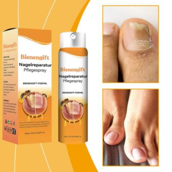 Bee Nagelbehandlingsspray - 20 ml - för Nageltillväxt & Hälsa Natur--