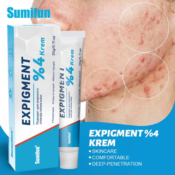 Expigment 4% ansiktskräm, för daglig ansiktsvård, förbättrar ojämn hudton, 20g 3pcs