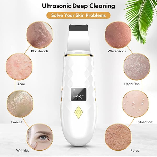 LX-1 stk. Elektrisk Blackhead Remover i plast (Hvit)