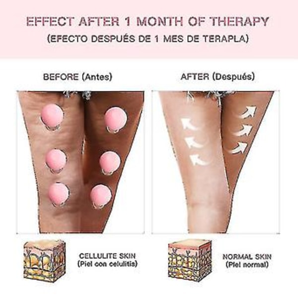 Gummimassagekroppskålar Vakuumkoppar Glas Ansiktslyft Kroppsansiktskoppar Anti Cellulite ( )