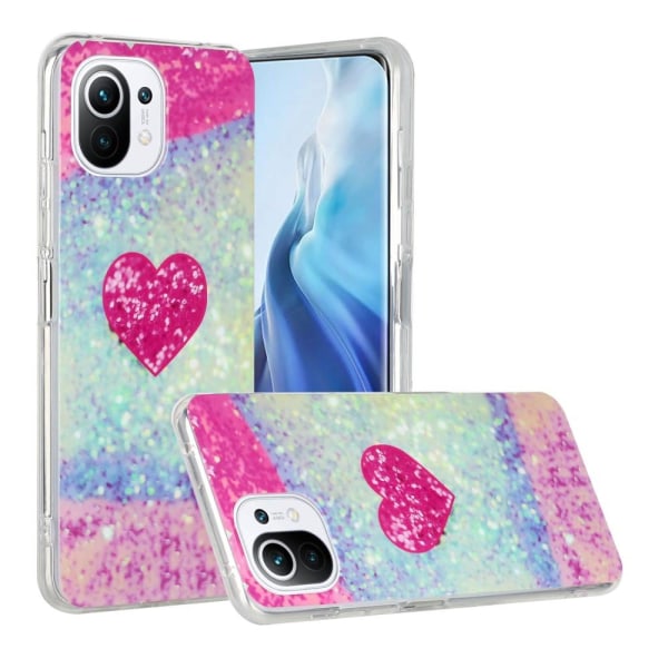 SKALO Xiaomi Mi 11 Lite Marmor TPU-skal - Motiv 5 Multicolor