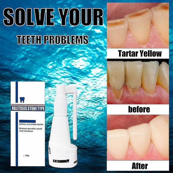 Hammaskiviä liuottava suihke hammaskivenpoistoaine Hampaiden puhdistusaine Suun hampaiden hoito