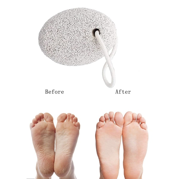 Pumice Stone For Feet 4 Pcs, Natural Pumice Stone