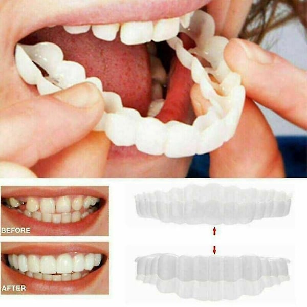 1 kpl Smile Snap On Ylähammasproteesi Hammaslaminaatit Tekohampaiden Suojus Tw