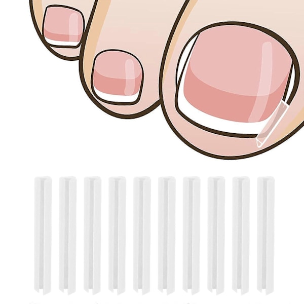10 st Ingrodda Tånagelskorrigeringsremsor Nagelspårskydd Återhämtningsklämmor Kvinnor