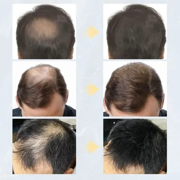 Vit - Toppik Hårstärkande Fiberpuderspray, Instant Salon, Hårvård, Pou