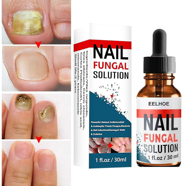 Negle Reparatør Opløsning Hånd & Fod Grå Neglepleje Reparation Grå Negle Opløsning - jue