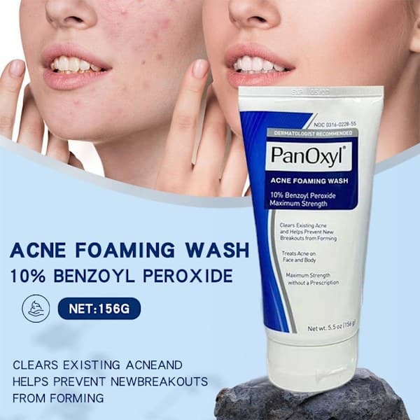 Panoxyl 10% Acne Foaming Wash Maximal styrka 5,5 oz. het 4% 1 st