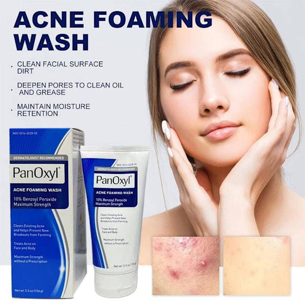 Panoxyl 10% Acne Foaming Wash Maximal styrka 5,5 oz. het 4% 1 st