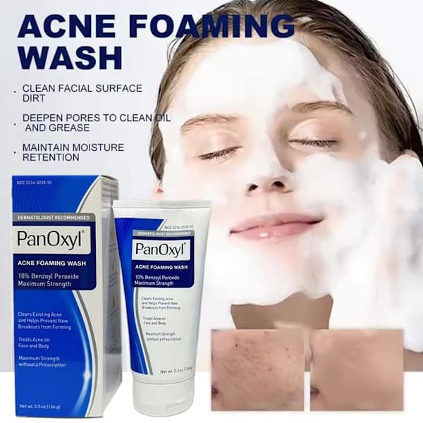 Panoxyl 10% Acne Foaming Wash Maximal styrka 5,5 oz. het 4% 1 st