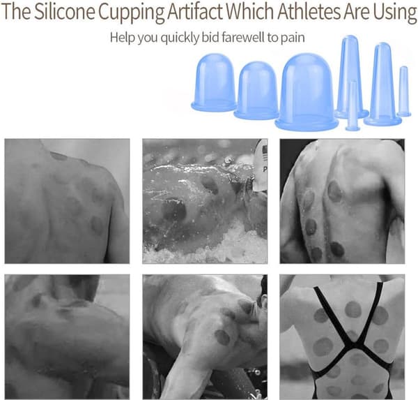 Cellulite Kopper - Cupping mod Cellulite - Premium Kvalitets Cupping Sæt (7 Dele) - Cupping Kopper